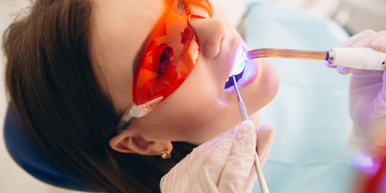 5 motive pentru care ar trebui să vă gândiți la albirea dinților