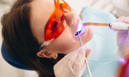 5 motive pentru care ar trebui să vă gândiți la albirea dinților