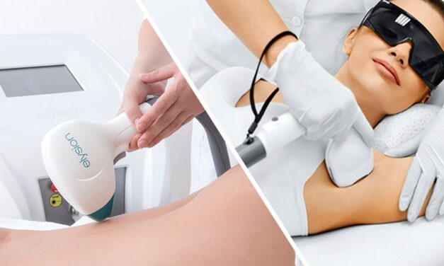 Este epilarea cu laser permanenta?