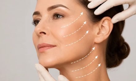 Ce trebuie să știi înainte de un Lifting Facial